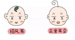 招风耳的男命运势