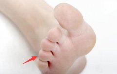 男人脚趾关节较大配眼角上扬的面相对性格命运事业运势的影响